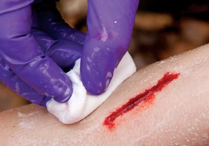 Wound Cleaning