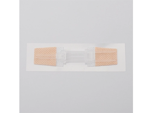 wound closure device