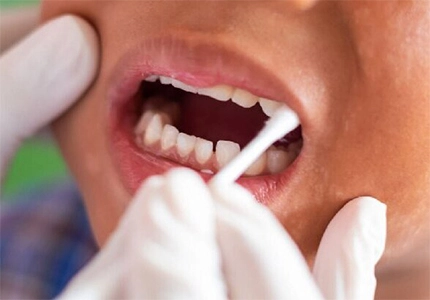 Dental Applications