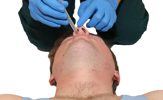 Insert the Nasopharyngeal Airway(NPA)